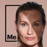 Cosmelan / Überpigmentierung Webinar