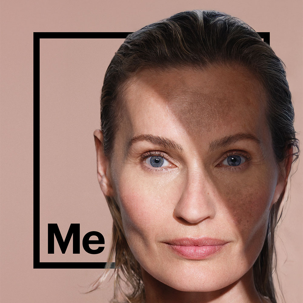 Cosmelan / Überpigmentierung Webinar